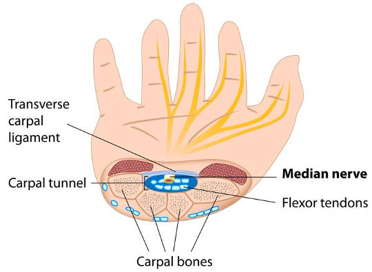 carpal tunnel diagram