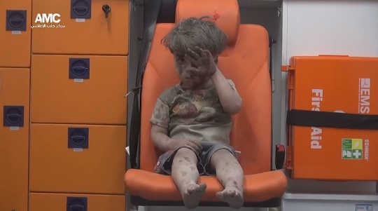 Five-year-old Omran Daqneesh in an ambulance after an alleged airstrike hit a house in Aleppo on August 17, 2016. ALEPPO MEDIA CENTER/@AleppoAMC