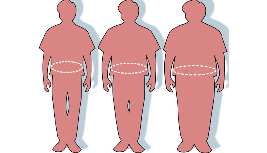Obese Patients Frequently Aren’t Getting An Obesity Diagnosis