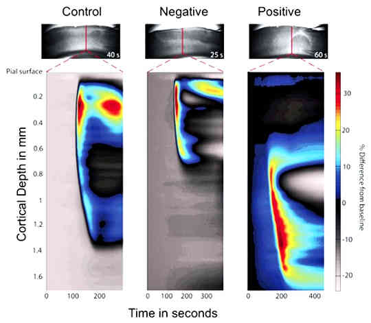 the optical images shows the wave of spreading depolarization in the brain