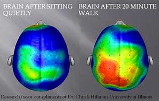 Brain scan of child before (left) and after (right) walking on a treadmill for 20 minutes. 