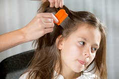 How To Get Rid Of Head Lice Without Spending Loads Of Money