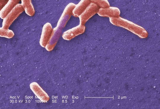How Gut Microbes Are Tiny Sensors Of Your General Health
