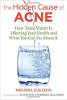 The Hidden Cause of Acne: How Toxic Water Is Affecting Your Health and What You Can Do about It by Melissa Gallico