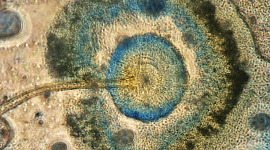 Aspergillus niger, the fungal dandelion Michael Taylor